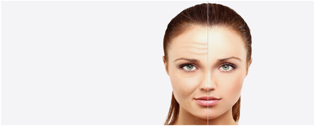 anti ageing anti aging treatment clinic in Noida