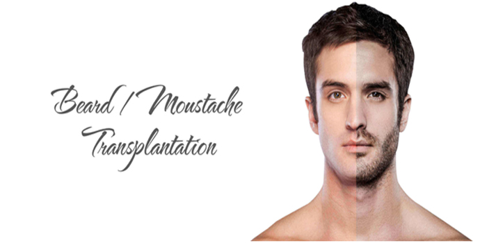 beard hair transplant clinic in Noida