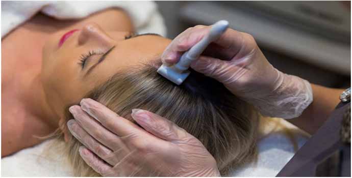 derma roller treatment in Noida