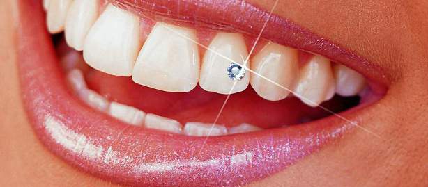 Tooth jewelry clinic in Noida Tooth jewelry clinic in Noida