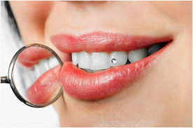 Tooth jewelry clinic Tooth jewelry clinic in Noida