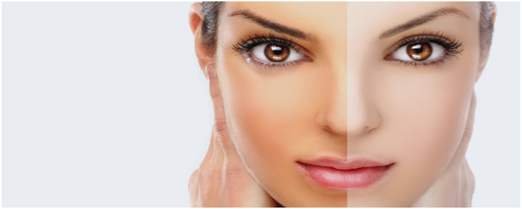 skin whitening treatment in Noida