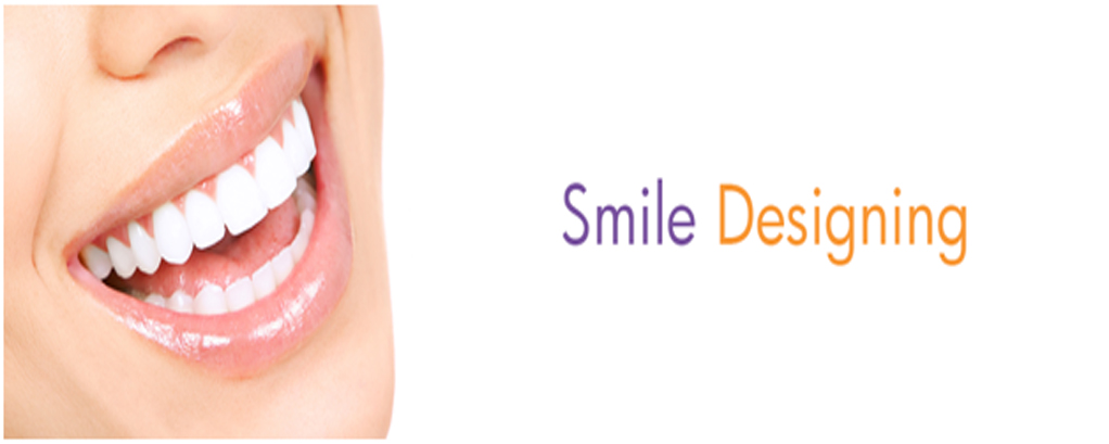 Smile designing in Noida