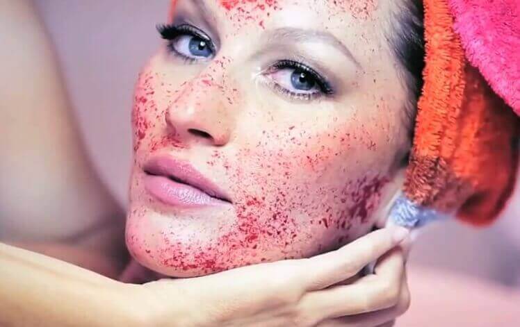 vampire facial in Noida