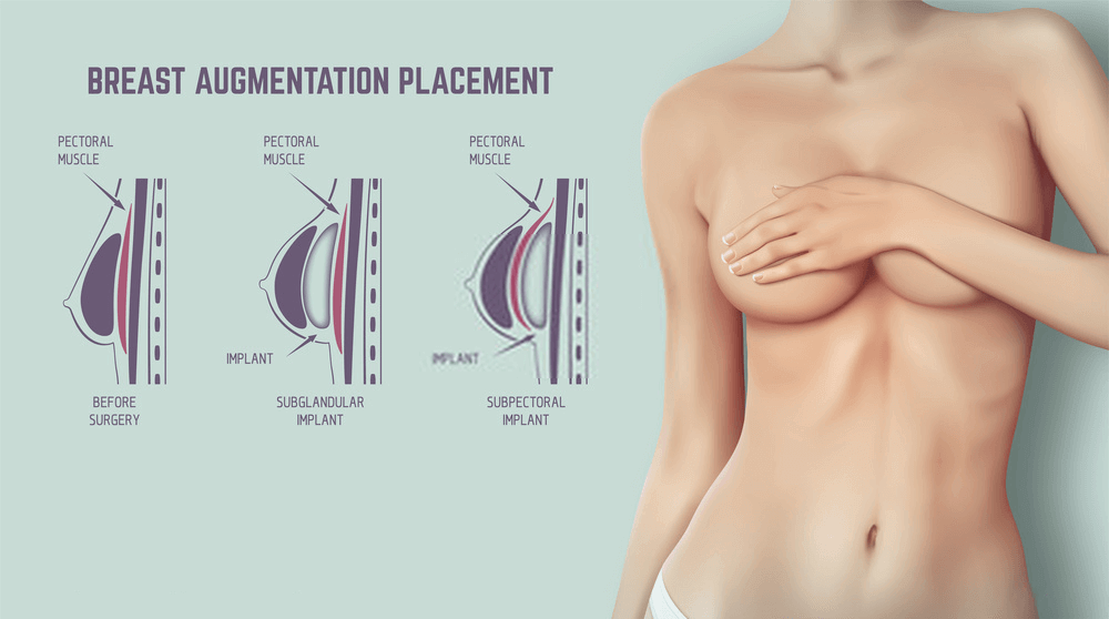 breast reduction uplifting in Noida breast reduction uplifting in Noida Delhi